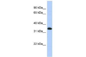 Western Blotting (WB) image for anti-Zinc Finger Protein 511 (ZNF511) antibody (ABIN2458281) (ZNF511 抗体)