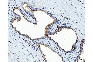 IHC analysis of BI-1/TMBIM6 using anti-BI-1/TMBIM6 antibody (ABIN7603199). (Bax Inhibitor 1 抗体  (N-Term))
