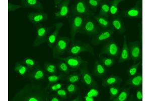 Immunofluorescence analysis of A549 cells using RFC1 antibody. (RFC1 抗体)