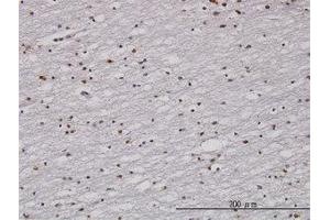 Image no. 1 for anti-Cell Cycle Checkpoint Protein RAD1 (RAD1) (AA 1-90) antibody (ABIN598565) (RAD1 抗体  (AA 1-90))
