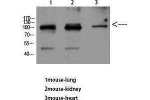Western Blot (WB) analysis of Mouse Lung Mouse Kidney Mouse Heart using VE-Cadherin Polyclonal Antibody diluted at 1:500. (Cadherin 5 抗体  (Internal Region))