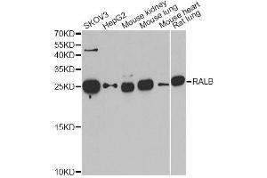 Western blot analysis of extracts of various cell lines, using RALB antibody. (RALB 抗体  (AA 1-206))