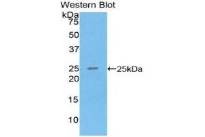 Detection of Recombinant SPRY3, Human using Polyclonal Antibody to Sprouty Homolog 3 (SPRY3) (SPRY3 抗体  (AA 91-288))