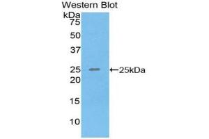 Detection of Recombinant SPRY3, Human using Polyclonal Antibody to Sprouty Homolog 3 (SPRY3)