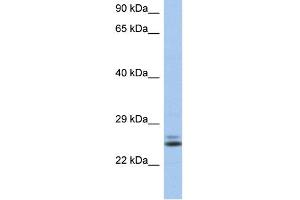 WB Suggested Anti-RAB15 Antibody Titration: 0. (RAB15 抗体  (N-Term))
