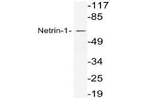 Western blot analysis of Netrin-1 antibody in extracts from COS7 cells. (Netrin 1 抗体)