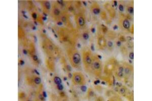 Used in DAB staining on fromalin fixed paraffin-embedded Liver tissue (TGFBI 抗体  (AA 423-632))