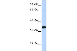 HAS3 antibody used at 1 ug/ml to detect target protein. (HAS3 抗体  (C-Term))