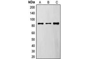 Western blot analysis of FYB expression in A549 (A), MDAMB435 (B), TF1 (C) whole cell lysates. (FYB 抗体  (C-Term))