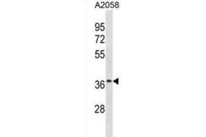 Western Blotting (WB) image for anti-Olfactory Receptor, Family 52, Subfamily J, Member 3 (OR52J3) antibody (ABIN3001032) (OR52J3 抗体)