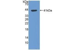 Detection of Recombinant TPS, Human using Polyclonal Antibody to Tryptase (TPS) (TPSAB1 抗体  (AA 161-262))