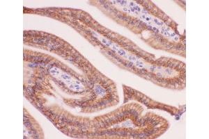 IHC-P: alpha Catenin antibody testing of mouse intestine tissue (CTNNA1 抗体  (AA 143-292))