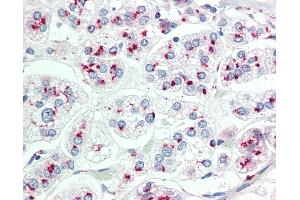 Anti-LIMD1 antibody IHC staining of human adrenal. (LIMD1 抗体  (AA 438-467))