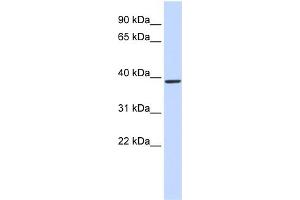 WB Suggested Anti-QPCT Antibody Titration:  0. (QPCT 抗体  (Middle Region))
