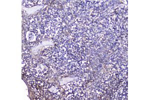 Immunohistochemistry (IHC) image for anti-Tumor Necrosis Factor Receptor Superfamily, Member 17 (TNFRSF17) (AA 1-54) antibody (ABIN5692955)