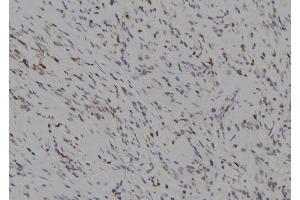 ABIN6277264 at 1/100 staining Human gastric tissue by IHC-P. (MMP14 抗体  (C-Term))