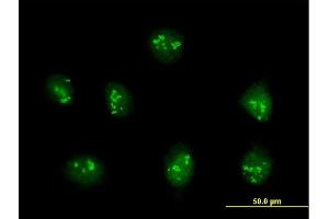 Immunofluorescence of purified MaxPab antibody to PDE9A on HeLa cell. (PDE9A 抗体  (AA 1-533))