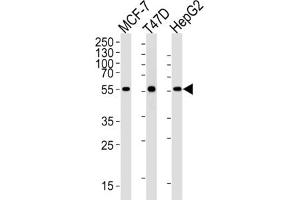 Western Blotting (WB) image for anti-Aldehyde Dehydrogenase 6 Family, Member A1 (ALDH6A1) antibody (ABIN2995317) (ALDH6A1 抗体)