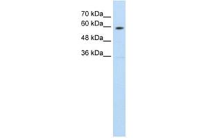 Western Blotting (WB) image for anti-Solute Carrier Family 11 (Proton-Coupled Divalent Metal Ion Transporters), Member 1 (SLC11A1) (C-Term) antibody (ABIN630354)
