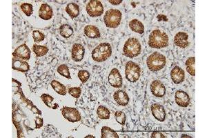 Immunohistochemistry (Formalin-fixed Paraffin-embedded Sections) (IHC (fp)) image for anti-Claudin 1 (CLDN1) (AA 1-211) antibody (ABIN563931)