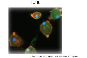 Sample Type: Human Macrophange CellsGreen: primaryRed: phallodinBlue: DAPIYellow: green/redPrimary Dilution: 1:200Secondary Antibody: anti-Rabbit IgG-FITCSecondary Dilution: 1:1000Image Submitted By: Milan FialaUniversity of California, Los Angeles (IL-1 beta 抗体  (N-Term))