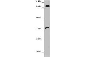 Western blot All lanes: DNMT3B antibody at 14 μg/mL + Hela whole cell lysate Secondary Goat polyclonal to rabbit IgG at 1/10000 dilution Predicted band size: 96, 94, 87, 81, 89, 95, 78, 82 kDa Observed band size: 96, 37 kDa (DNMT3B 抗体  (AA 1-100))