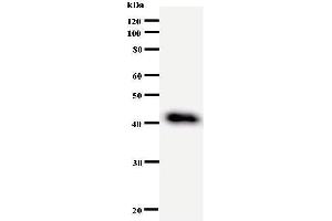 Western Blotting (WB) image for anti-DEAD (Asp-Glu-Ala-Asp) Box Polypeptide 27 (DDX27) antibody (ABIN933004) (DDX27 抗体)