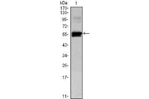 Western Blot showing PAX6 antibody used against human PAX6 (AA: 1-223) recombinant protein. (PAX6 抗体)