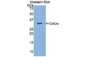 Western blot analysis of the recombinant protein. (CD38 抗体  (AA 54-301))