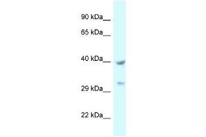 Western Blot showing STOML2 antibody used at a concentration of 1 ug/ml against 721_B Cell Lysate (STOML2 抗体  (C-Term))