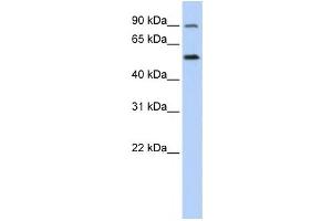 Western Blotting (WB) image for anti-Solute Carrier Family 41, Member 1 (SLC41A1) antibody (ABIN2458818) (SLC41A1 抗体)
