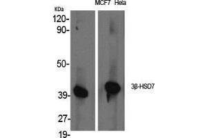 Western Blot (WB) analysis of specific cells using 3beta-HSD7 Polyclonal Antibody. (3beta-HSD7 (Internal Region) 抗体)