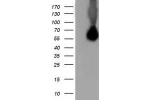 Image no. 1 for anti-Sequestosome 1 (SQSTM1) antibody (ABIN1499991) (SQSTM1 抗体)