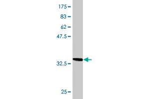 Western Blot detection against Immunogen (36. (TOM1 抗体  (AA 394-491))