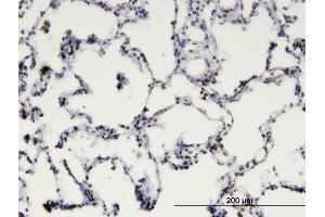 Immunoperoxidase of monoclonal antibody to MBD1 on formalin-fixed paraffin-embedded human lung. (MBD1 抗体  (AA 415-508))