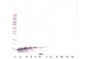 Image no. 3 for anti-gamma-Interferon-Induced Monokine (CXCL9) antibody (ABIN465139) (CXCL9 抗体)