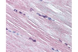 Anti-AMPD1 antibody IHC of human skeletal muscle. (AMPD1 抗体  (AA 140-190))