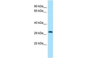 Host: Rabbit Target Name: PIH1D1 Sample Type: A549 Whole Cell lysates Antibody Dilution: 1. (PIH1D1 抗体  (C-Term))