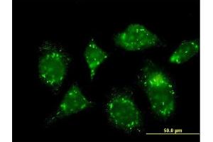 Immunofluorescence of monoclonal antibody to RABGAP1 on HeLa cell. (RABGAP1 抗体  (AA 1-110))