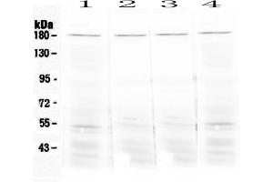 Western blot analysis of Ace using anti-Ace antibody . (Angiotensin I Converting Enzyme 1 抗体)