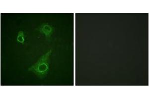Immunofluorescence analysis of HepG2 cells, using Epo-R (Phospho-Tyr368) Antibody. (EPOR 抗体  (pTyr368))