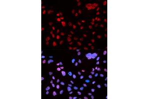 Immunofluorescence (IF) image for anti-Tumor Protein P53 (TP53) (pSer9) antibody (ABIN3023604)