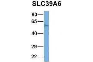 Western Blotting (WB) image for anti-Solute Carrier Family 39 (Zinc Transporter), Member 6 (SLC39A6) (Middle Region) antibody (ABIN2781630)