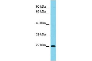 Host: Rabbit Target Name: C1orf158 Sample Type: Jurkat Whole Cell lysates Antibody Dilution: 1. (C1ORF158 抗体  (N-Term))