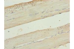 Immunohistochemistry of paraffin-embedded human skeletal muscle tissue using ABIN7157468 at dilution of 1:100 (KRT8 抗体  (AA 1-300))