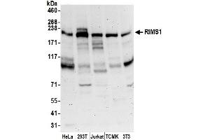 Western Blotting (WB) image for anti-Regulating Synaptic Membrane Exocytosis 1 (RIMS1) (AA 975-1025) antibody (ABIN7453183)