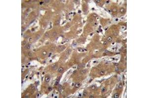 Immunohistochemistry analysis in human liver tissue (Formalin-fixed, Paraffin-embedded) using SPOPL Antibody , followed by peroxidase conjugation of the secondary antibody and DAB staining.