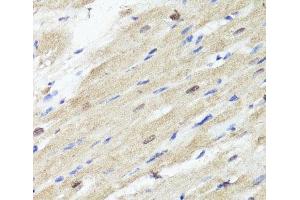 Immunohistochemistry of paraffin-embedded Rat heart using ACSS2 Polyclonal Antibody at dilution of 1:100 (40x lens). (ACSS2 抗体)