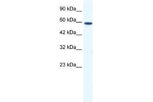 WB Suggested Anti-DDX5 Antibody Titration:  1. (DDX5 抗体  (N-Term))