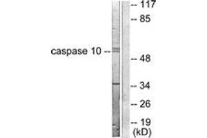Western blot analysis of extracts from HeLa cells, using Caspase 10 Antibody. (Caspase 10 抗体  (AA 430-479))